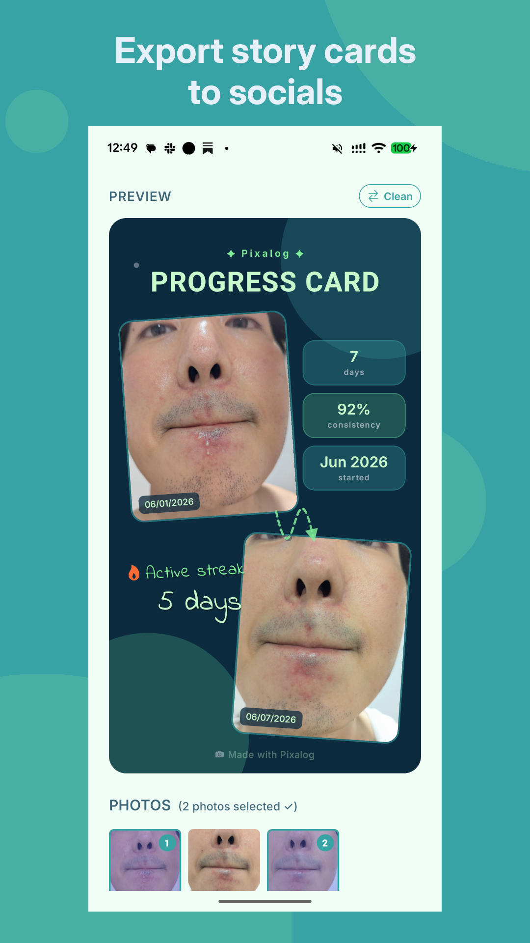 Pixalog story card export